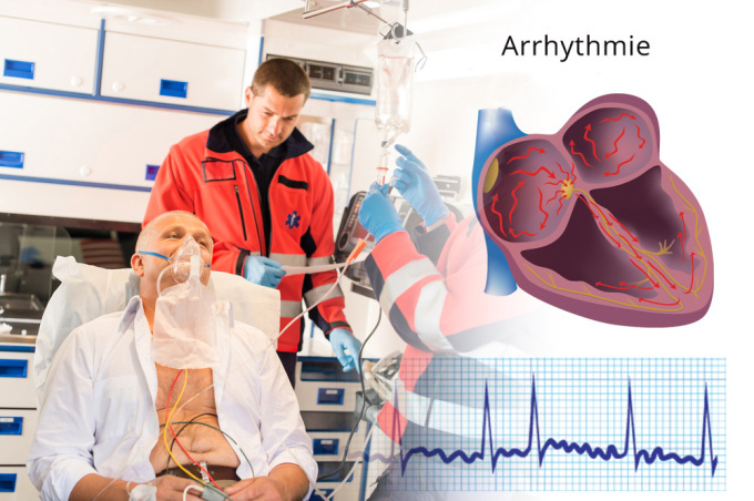 Herzarrhythmie