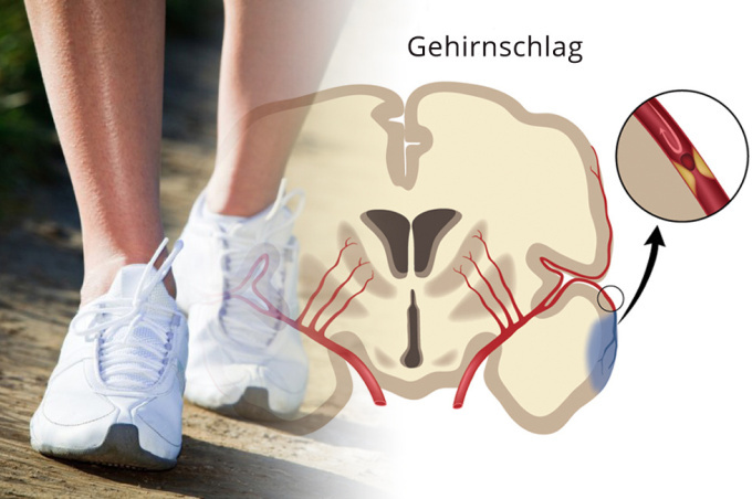 Gehstörungen