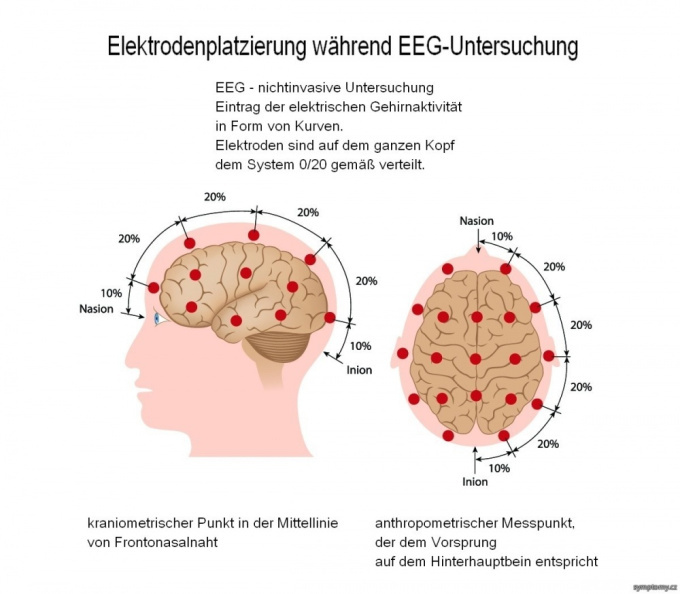 Elektrodenplatzierung während EEG - Untersuchung