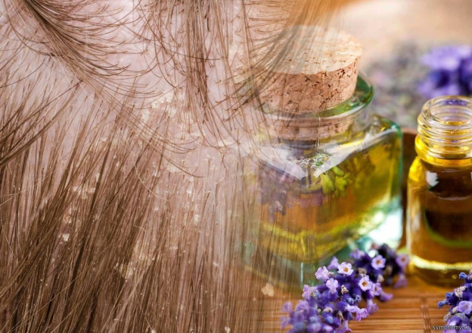 Schuppen im Haar