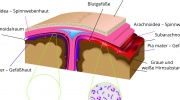 Meningokokkenmeningitis