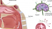 Non-Hodgkin-Lymphom