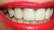 Empfindlichkeit der Zähne