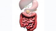 Morbus Crohn