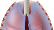 Pneumothorax