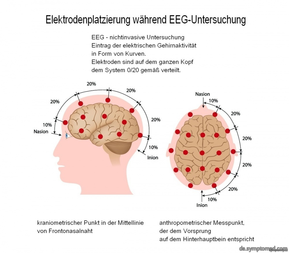 Elektrodenplatzierung während EEG - Untersuchung